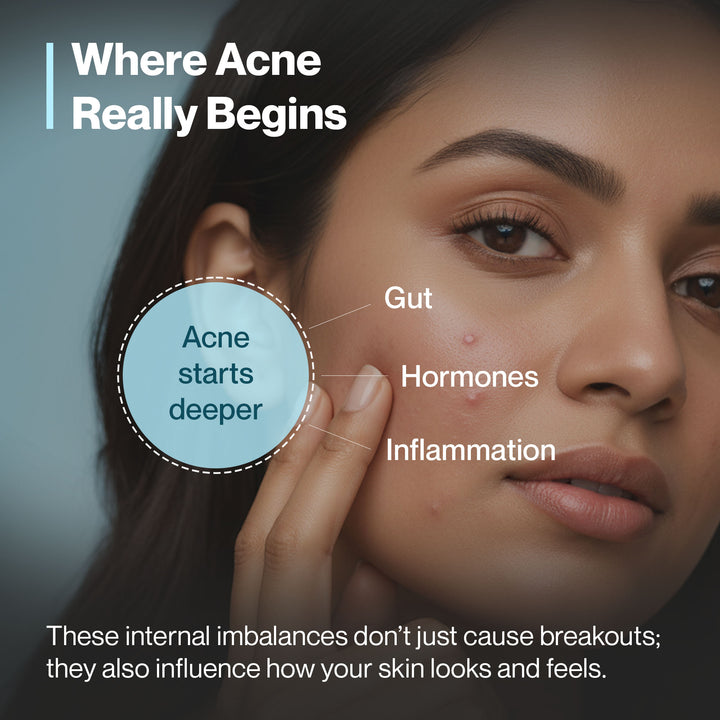 Clear Skin Combo – Anti-Acne, Spot Reduction & Skin Glow Kit